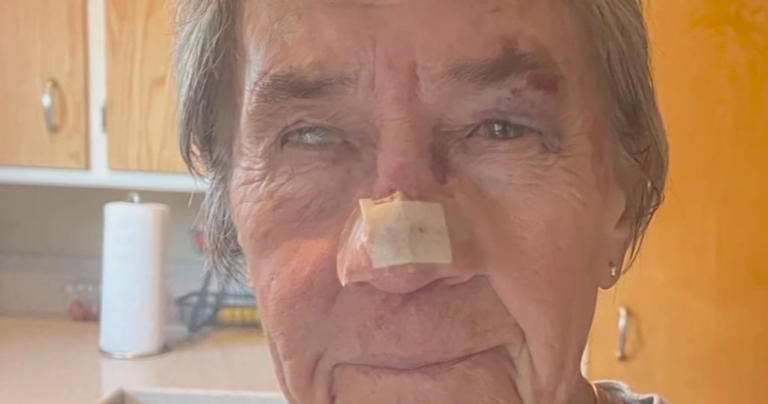 California woman left with horrific injuries after being attacked by ...