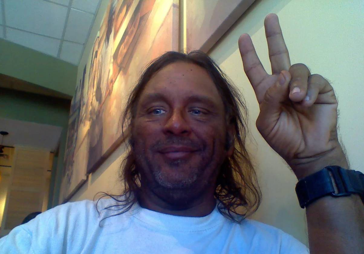 Man who's injected Melanotan II for years shares before and after photos