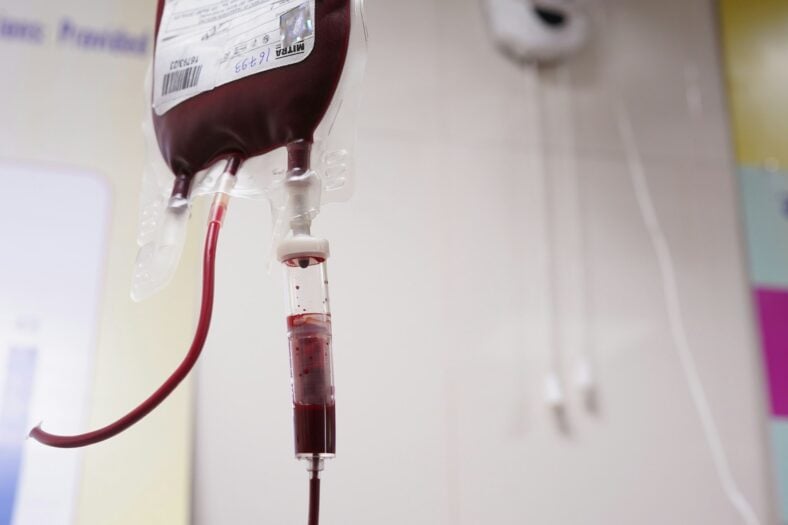 Draining blood from the body cured virtually every illness