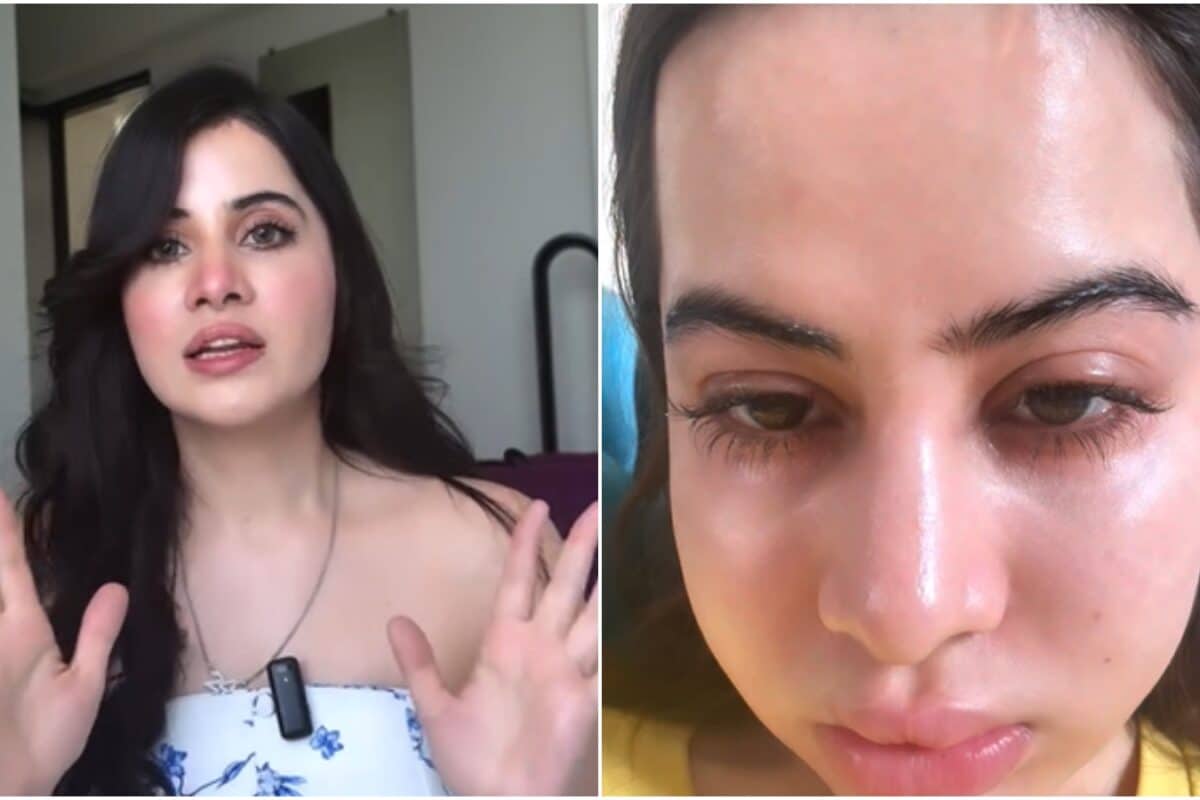 ‘Wasn’t a case of fillers gone wrong’: Uorfi Javed reveals what really ...