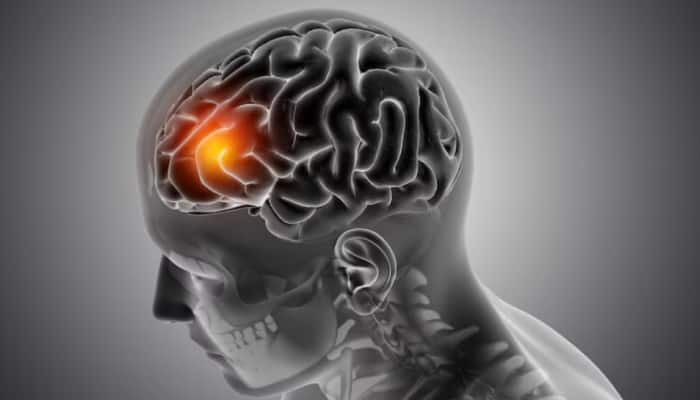 World Brain Tumour Day: 8 warning signs of brain tumours in children ...
