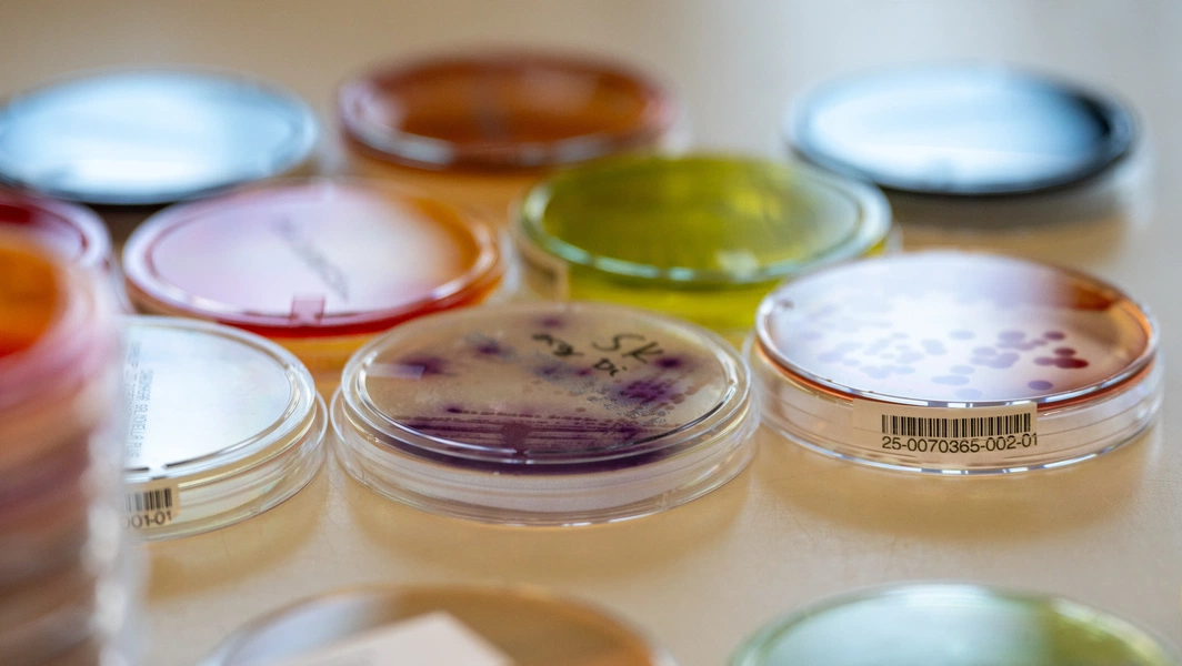 Microbial community research points to health and farm gains