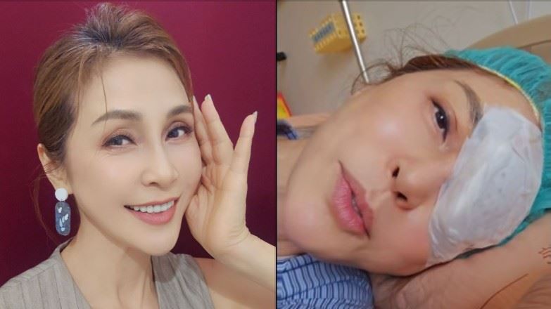 梁佑南驚曝右眼視力剩0.5!看劇本全霧掉急動刀 醫警告恐引爆白內障