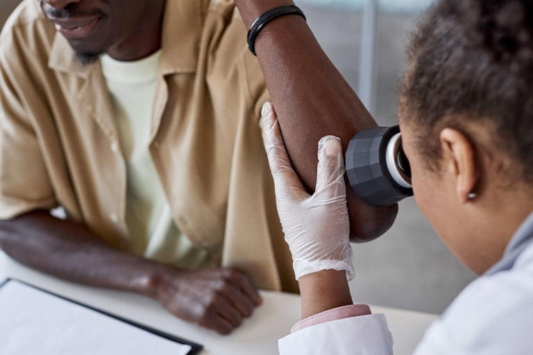 What does skin cancer look like?