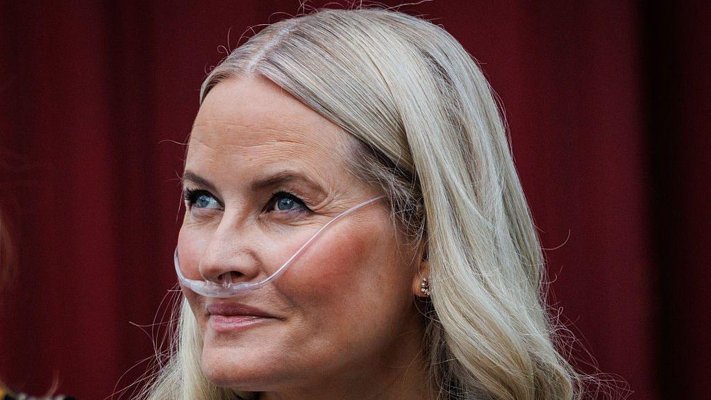 La princesa heredera de Noruega se somete con éxito a un trasplante de pulmón, según informa el palacio.