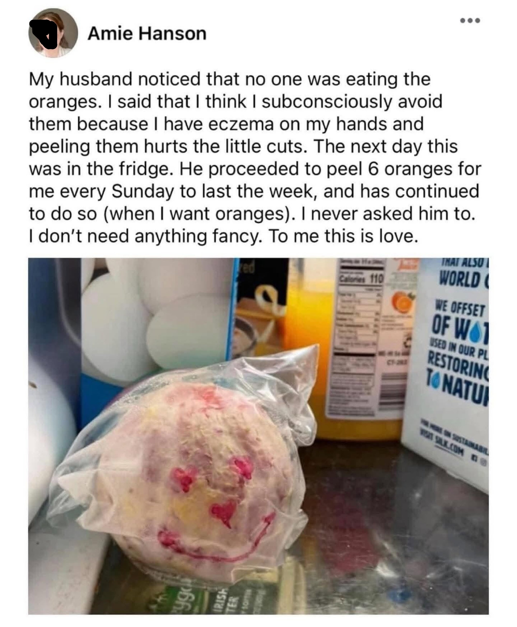 A person shares a story about their husband peeling oranges for them weekly as an act of love because eczema makes it painful for them to do so