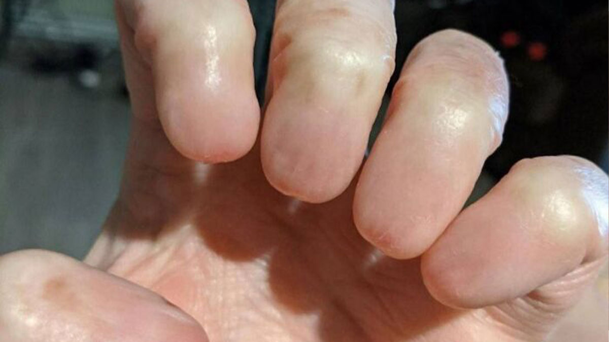 36 rare biological traits that show the wonders of human genetics