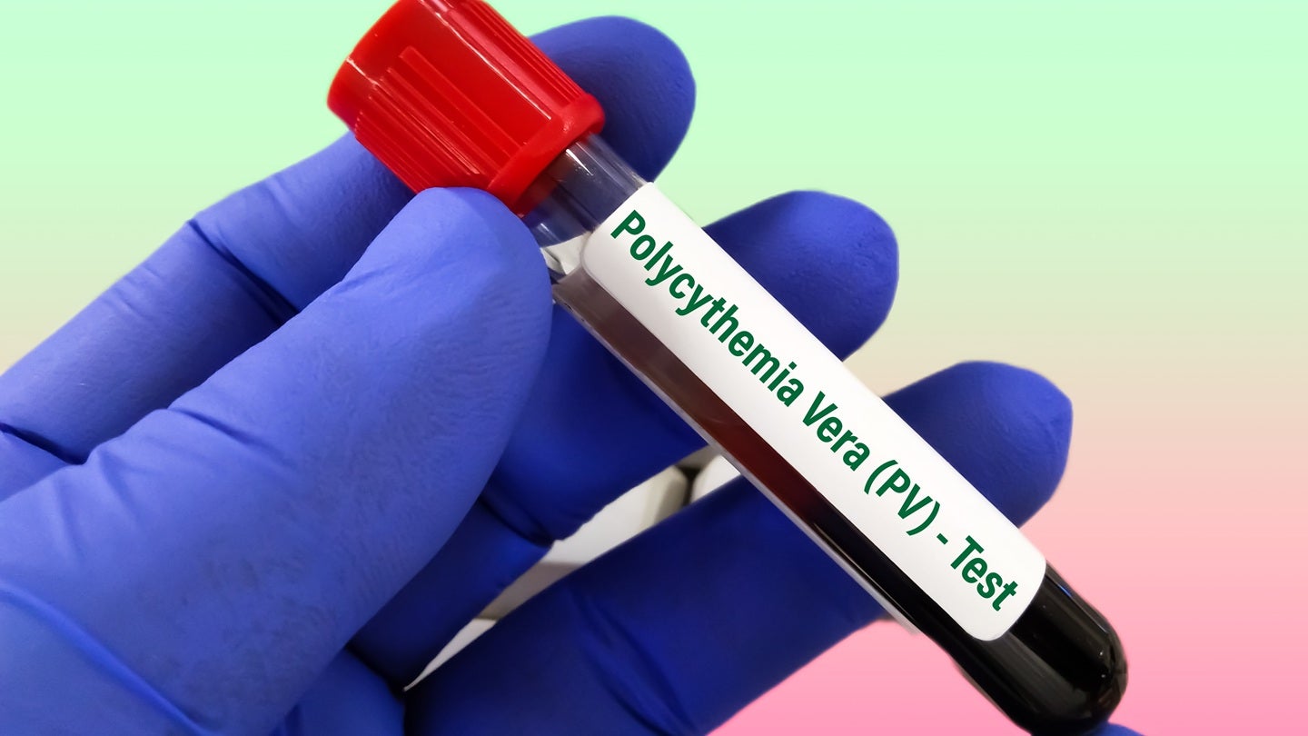 First patient dosed in Deciphera’s Phase III INTREPID study