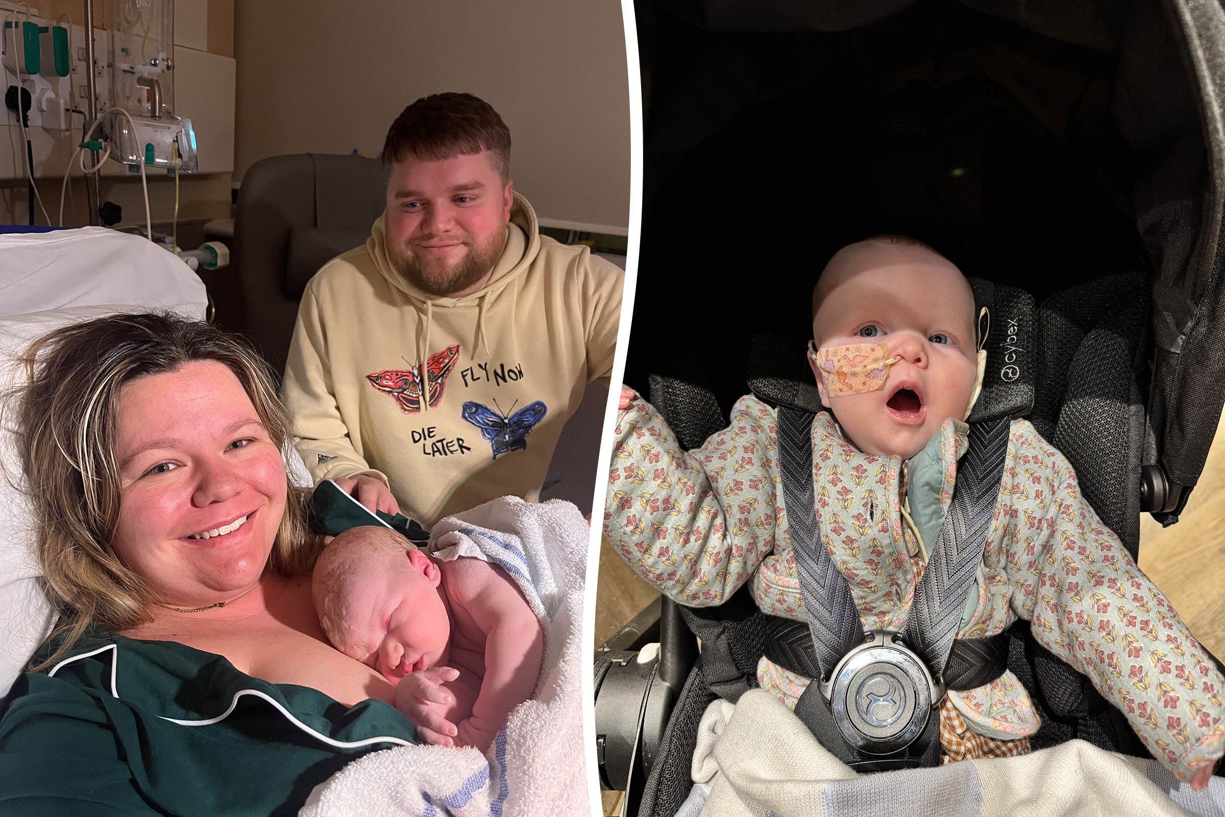 Baby’s feeding struggles were actually rare genetic condition