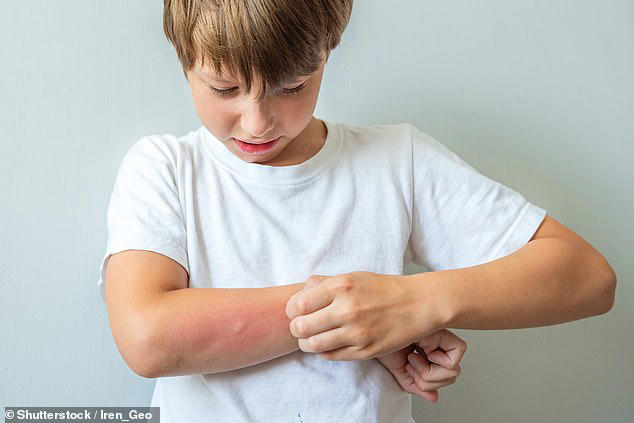 Exposing children to eggs early in life may help ward off allergies in the years to come, a study suggests