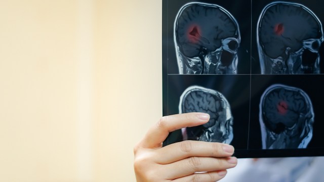 Wireless brain implant sends camera signals straight to the visual ...