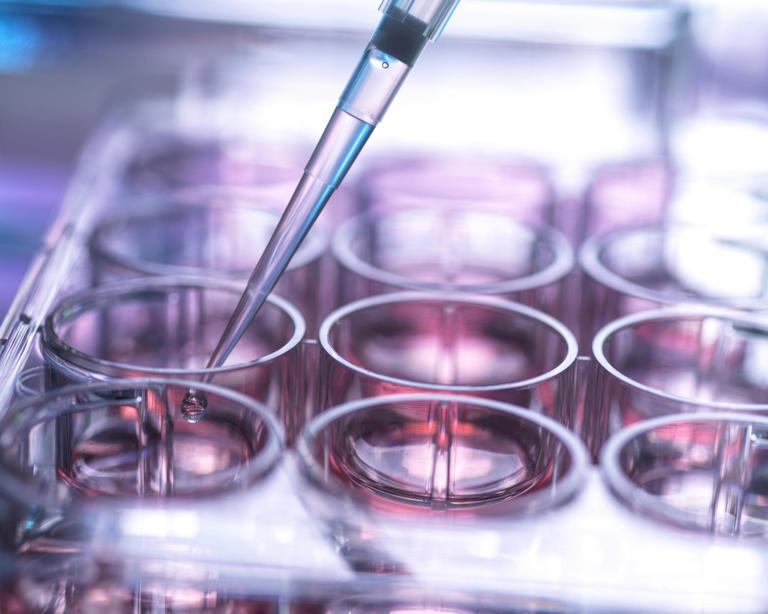 The review found that only 24% of stem cell transplants in the UK used a UK donor. Experts say reliance on overseas donors is costly and risks supply chain problems. Photograph: Andrew Brookes/Getty Images/Image Source