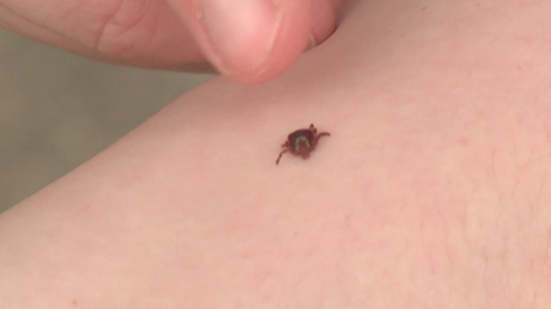 Wisconsin Department of Health Services tracking high levels of tick ...