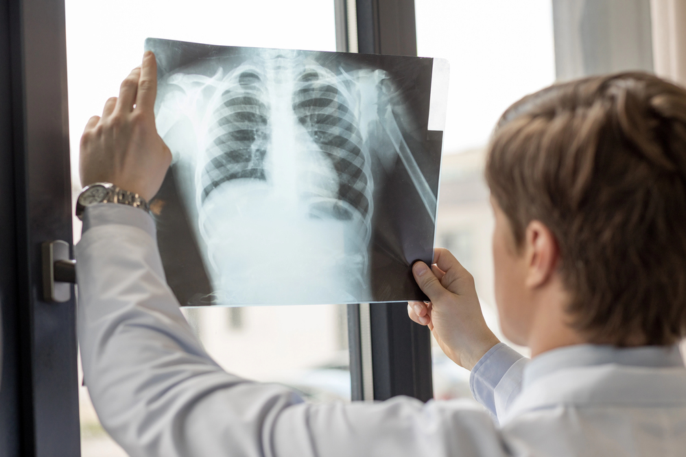 19 scientific discoveries made studying something else