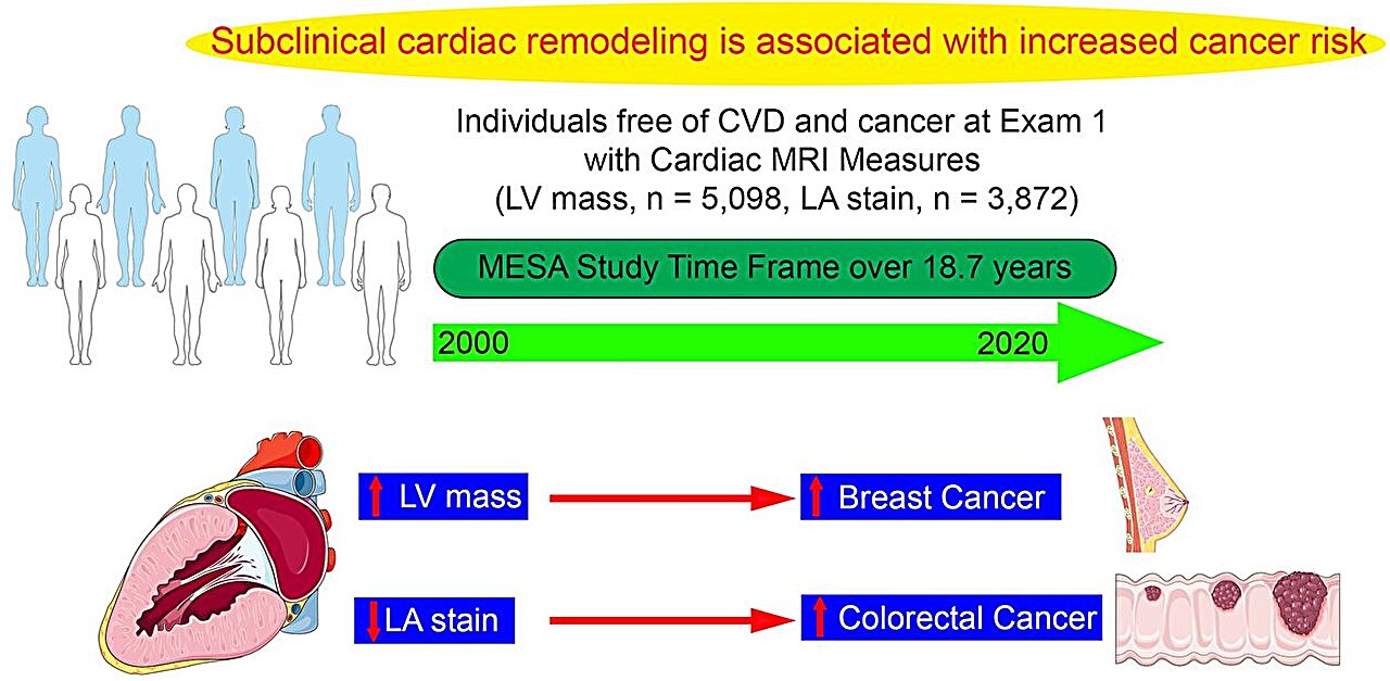 Early heart changes may predict cancer years before diagnosis, long ...