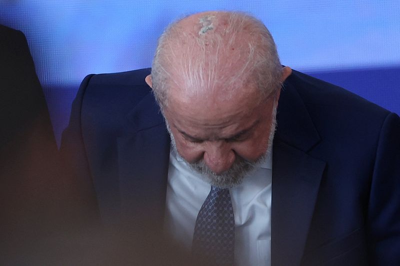 Lula conclui tratamento de radioterapia para câncer no couro cabeludo