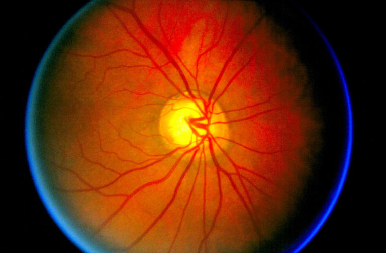 Trial of age reversing drug done on humans for first time