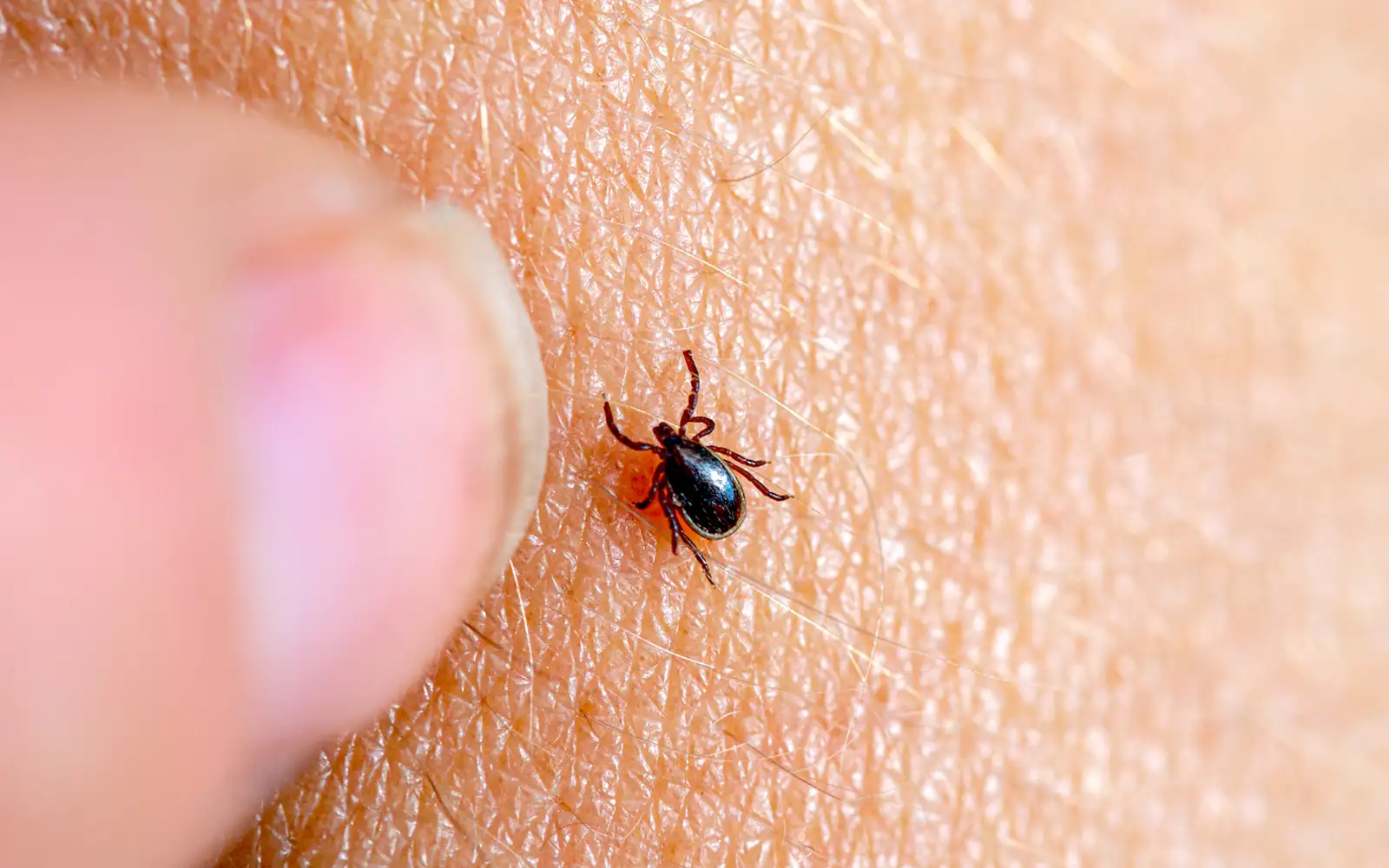Why some red-meat lovers have a beef with ticks