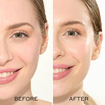 Before-and-after images of a woman's face, showing smoother, glowing skin in the