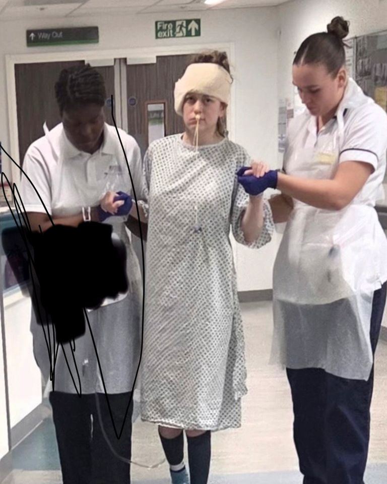 Sophie Martin, in hospital. A woman who thought her loss of hearing was due to playing loud music was shocked to find out it was a symptom of a rare genetic brain tumour. Sophie Martin, 29, noticed her earphones getting quieter but didn’t think much of it until she started to develop tinnitus. In June 2025, five months after her symptoms started, Sophie, from the Lake District, Cumbria, went to see her GP who referred her for a CT scan, which showed a mass on her brain. To her horror, Sophie was diagnosed with neurofibromatosis type 2 (NF2)