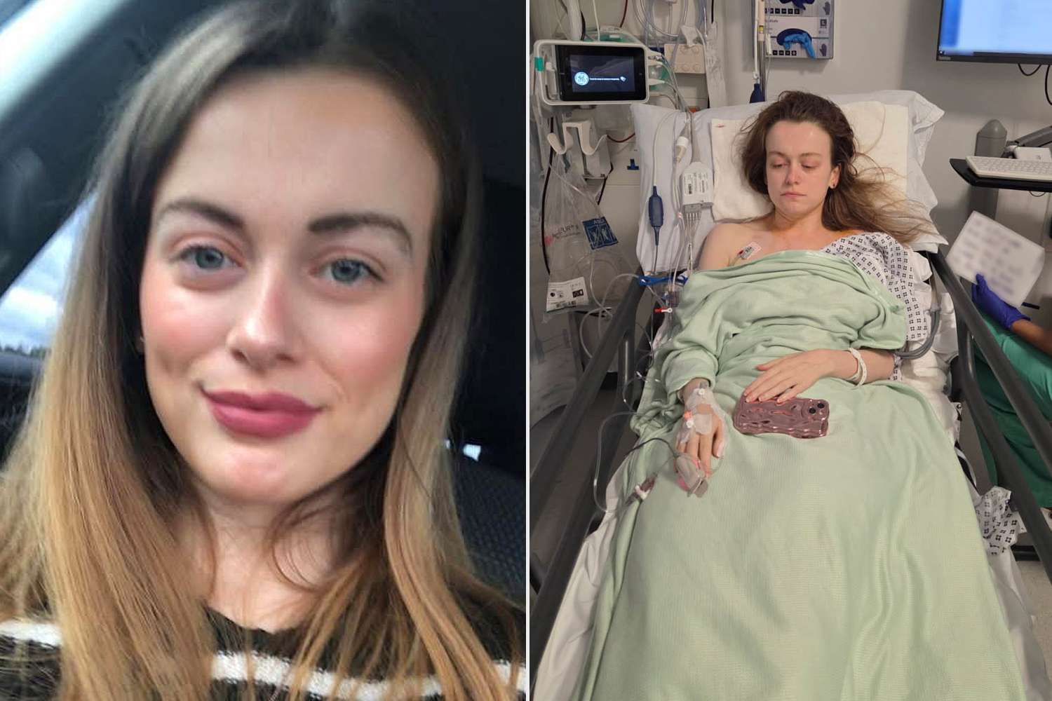 Woman, 29, thought her hearing loss was from blasting music too loud. Then doctors found 7 brain tumors