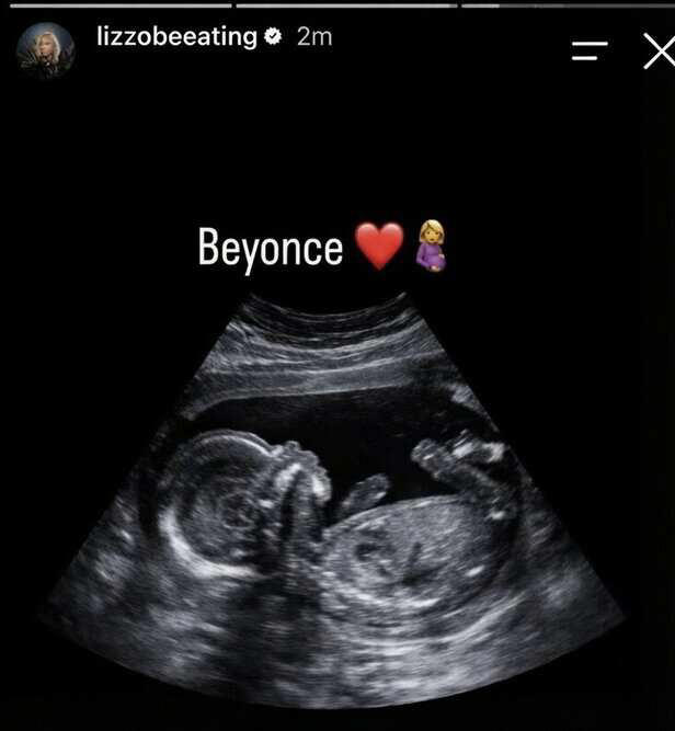 Is rapper Lizzo expecting a child with her long-time boyfriend Myke ...
