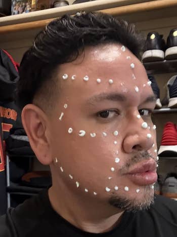 Person with dotted skincare product on the face stands in a closet with clothes and shoes displayed on shelves