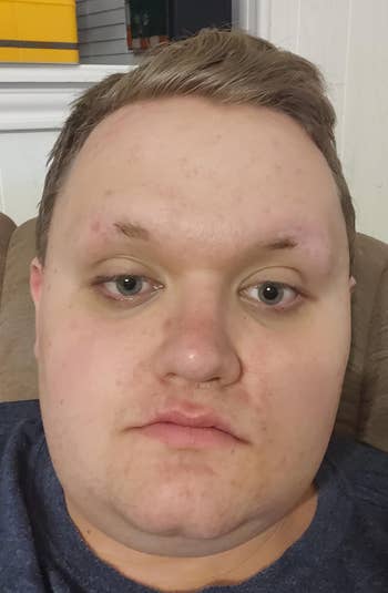 A person sitting on a couch indoors, looking directly at the camera with a neutral expression