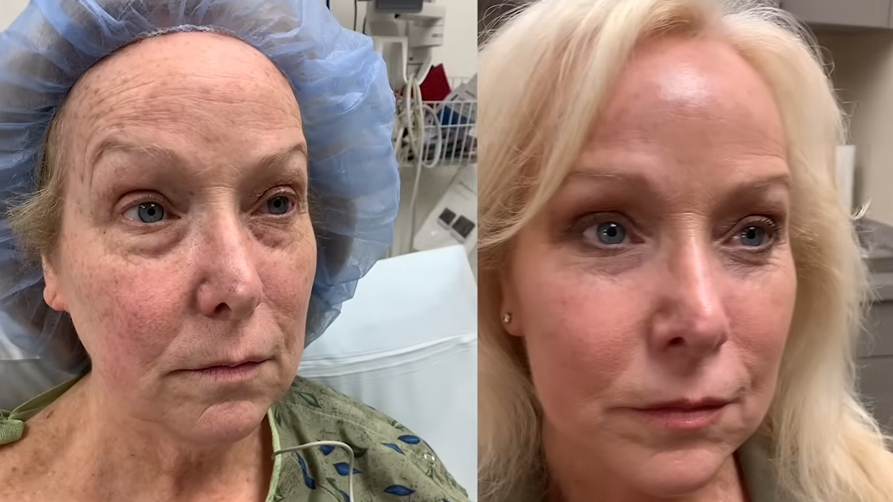 Can a makeover help her look years younger before the wedding?