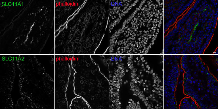 Intestinal cells starve Salmonella of essential nutrients, revealing ...