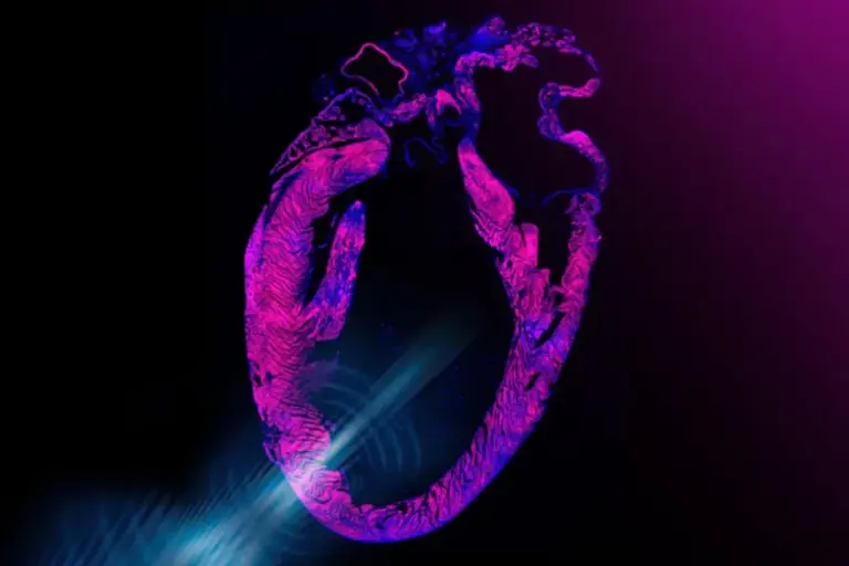 No implant, no surgery: this revolutionary heart patch could save lives