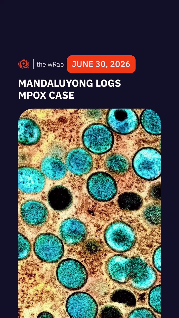 Mandaluyong logs Mpox case, DOH assures no outbreak