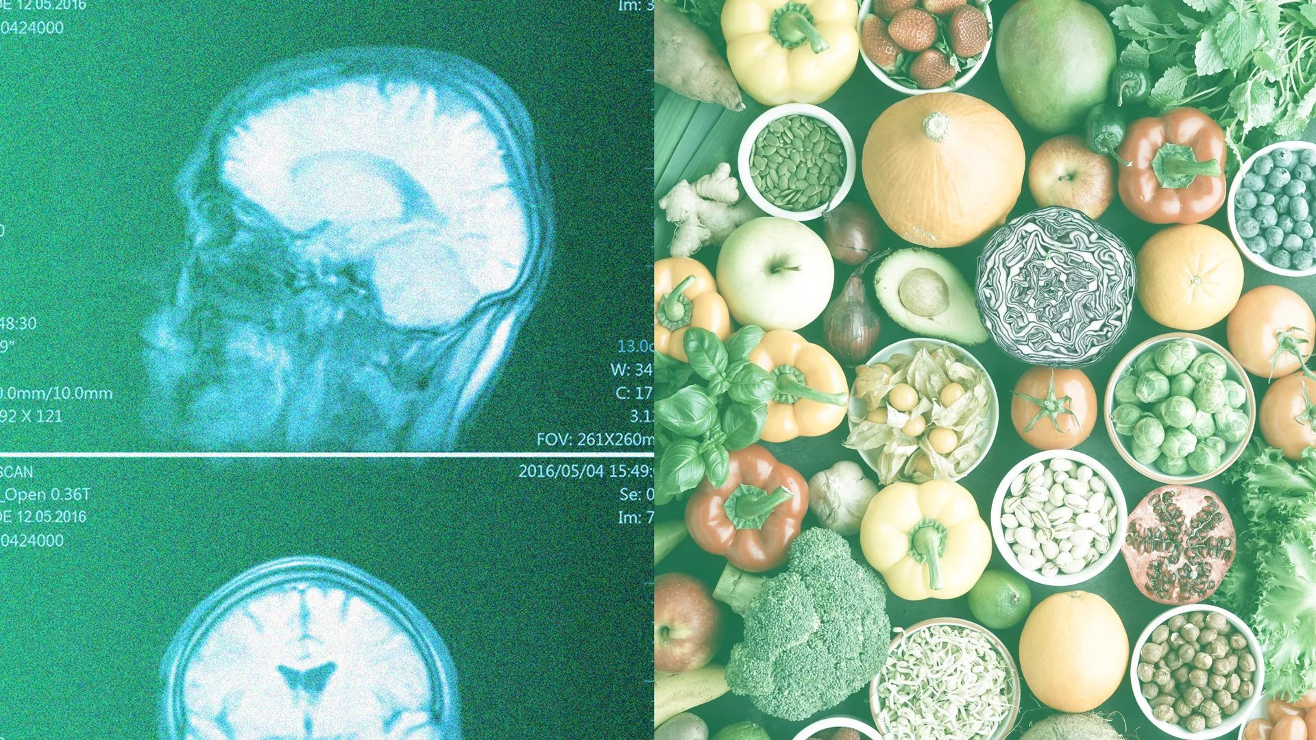 Even if you eat enough veggies, you’re probably missing this brain ...