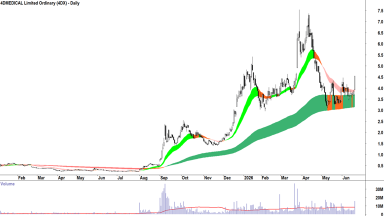 ChartWatch ASX scans: CSL, 4DMedical, Pro Medicus, Life360, Aristocrat ...