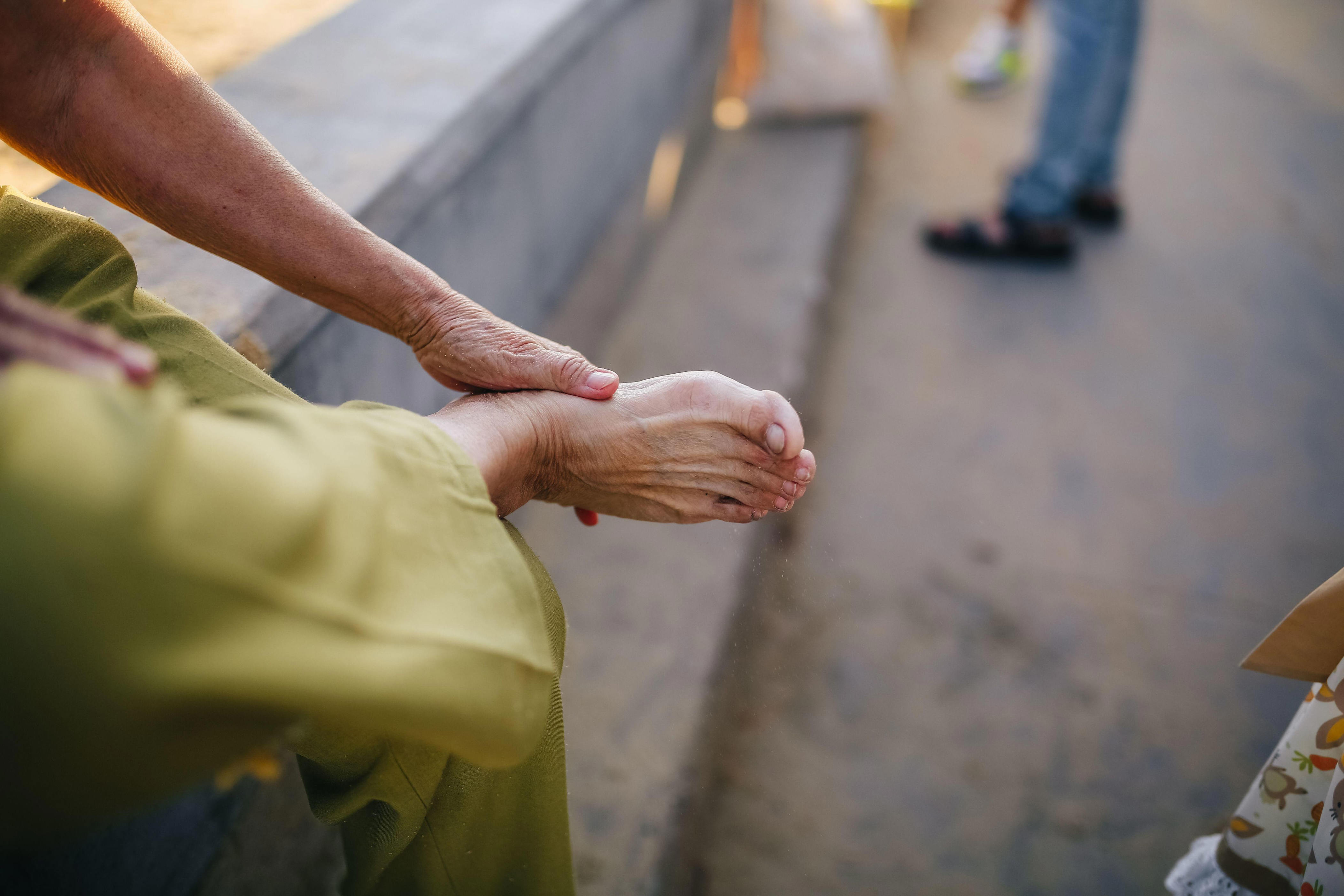 Vitamin B12 deficiency often shows up in the feet first, watch out for ...