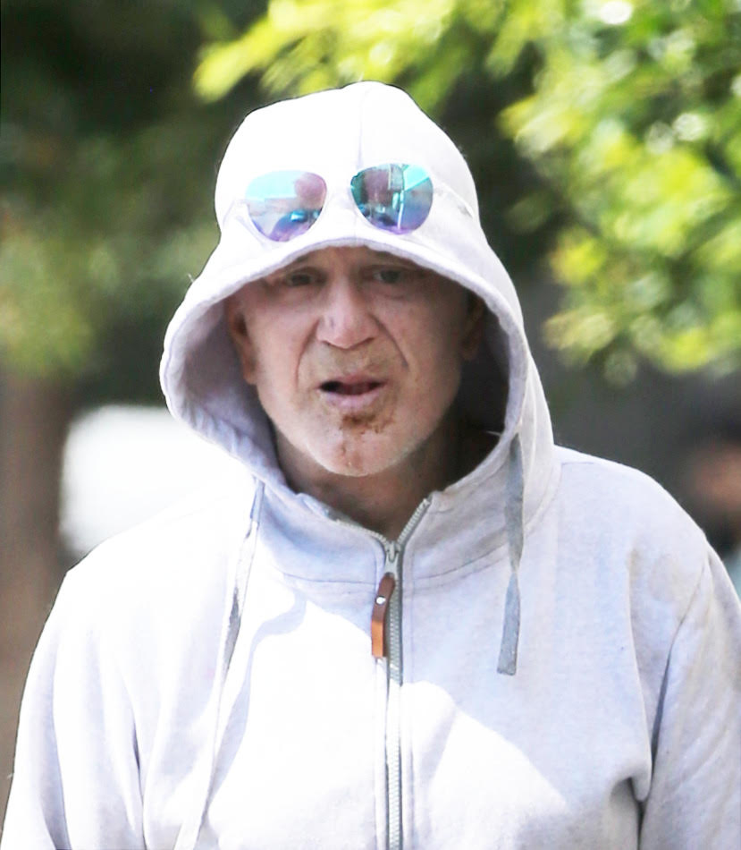Disheveled Mickey Rourke shows off missing teeth after being evicted ...