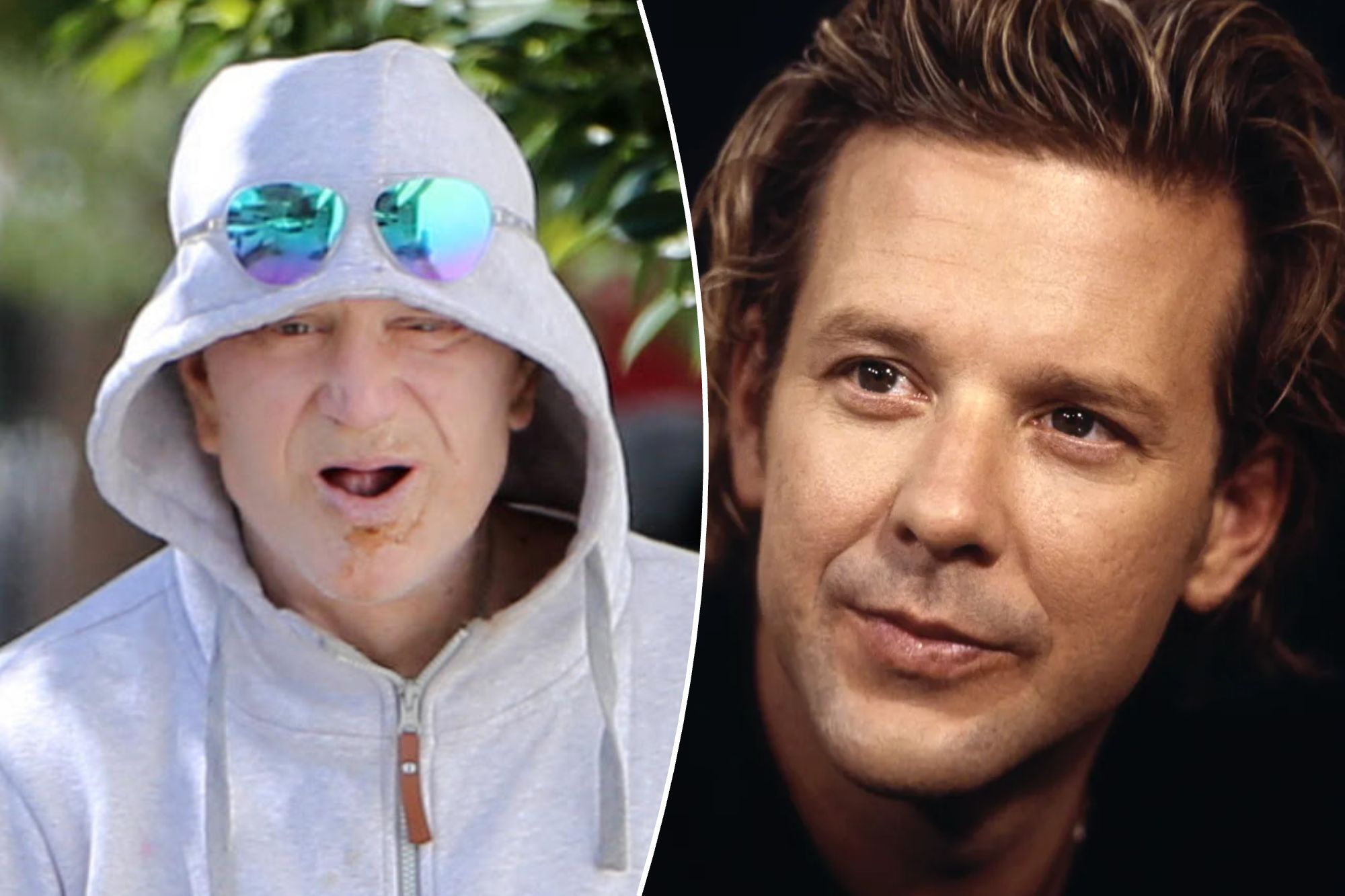 What happened to Mickey Rourke’s teeth? Surgeon explains trauma and ...