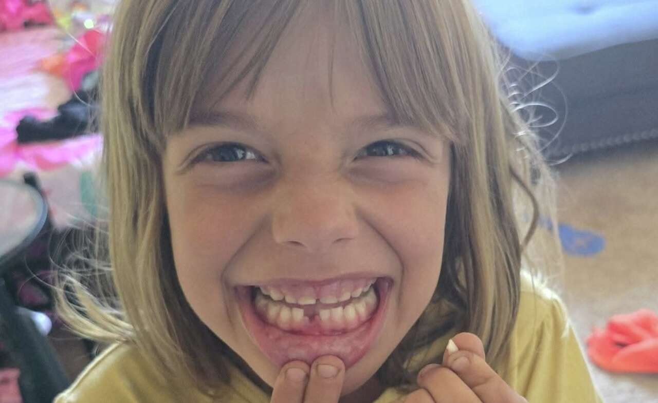 7-year-old girl seriously injured in Northern California dog attack