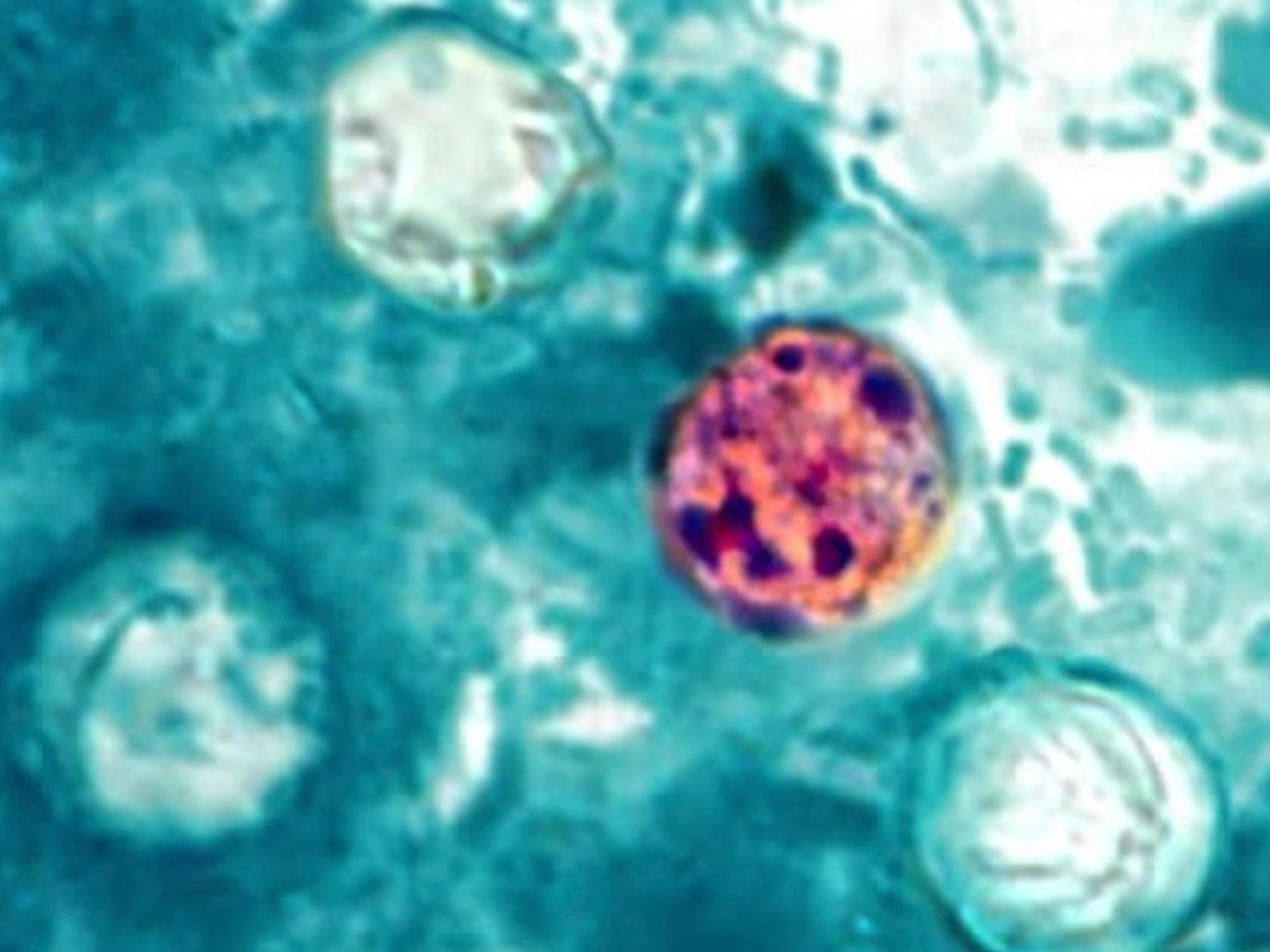 What we still don't know about the cyclosporiasis outbreak as cases rise