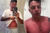 8 common sunscreen mistakes upping your risk of deadly melanoma