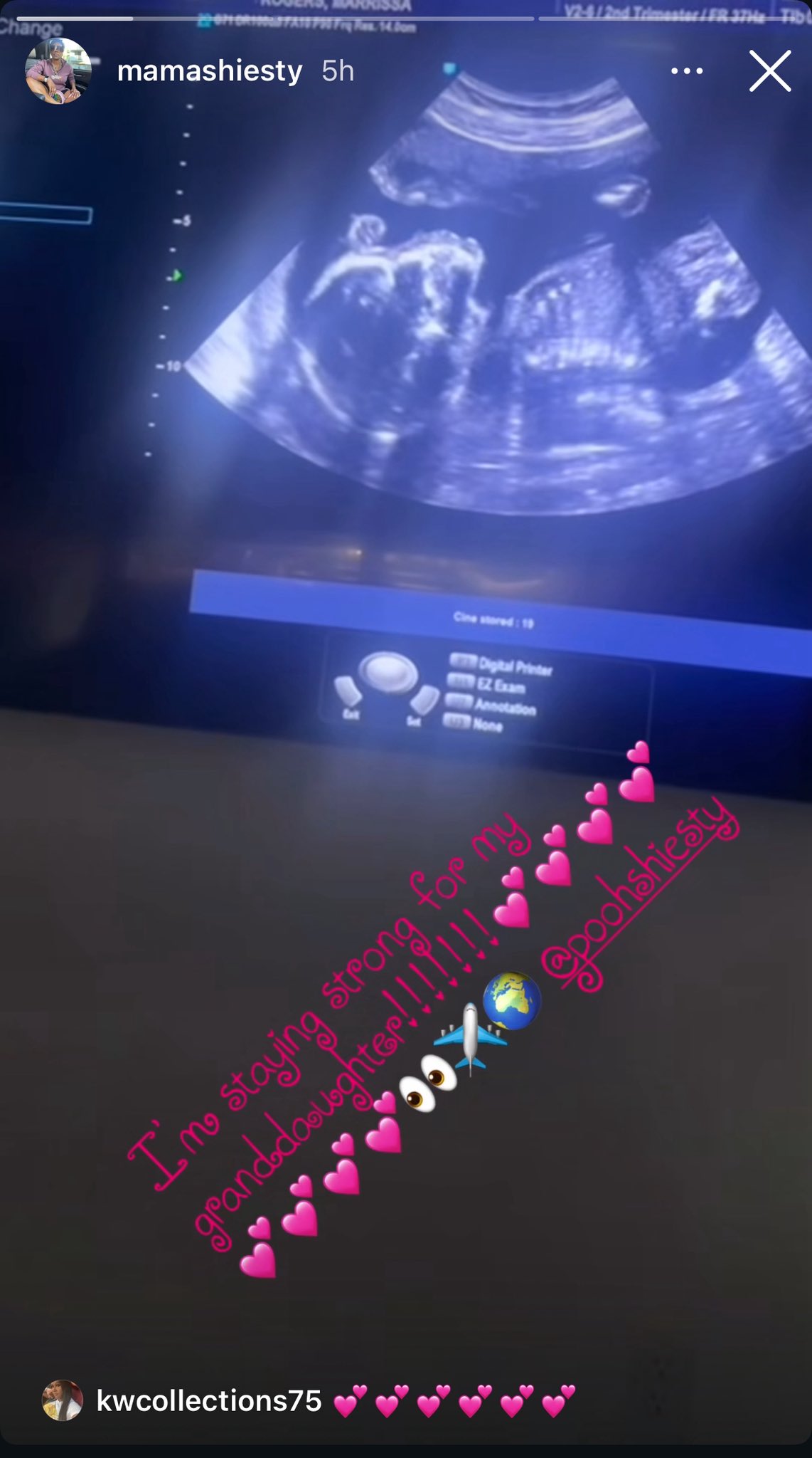 Pooh Shiesty may have a baby loading while facing decades in federal prison