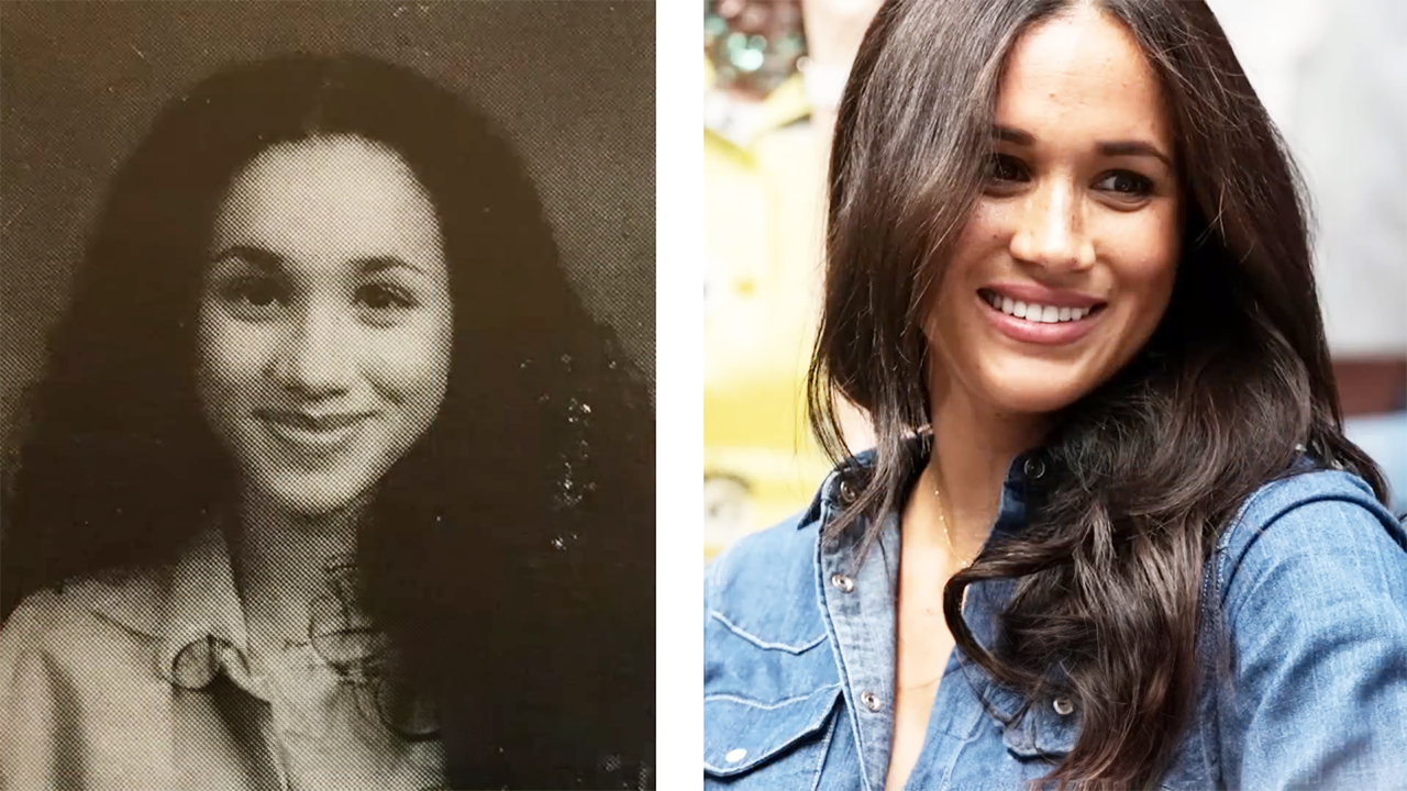 Featured - Meghan Markle Plastic Surgery