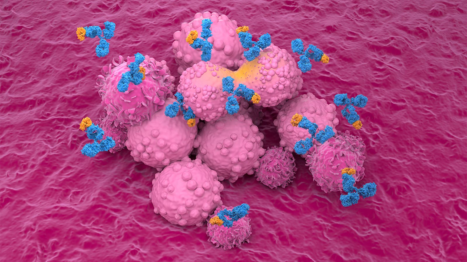 ADCs continue to make first-line inroads in triple-negative breast cancer