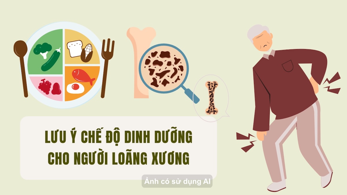 Lưu ý chế độ dinh dưỡng cho người loãng xương