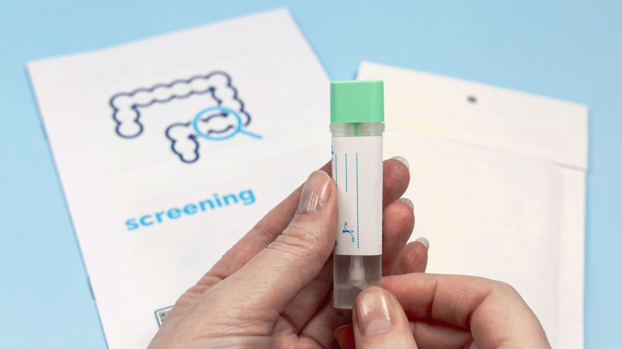 People in their 50s urged to complete life-saving bowel cancer test