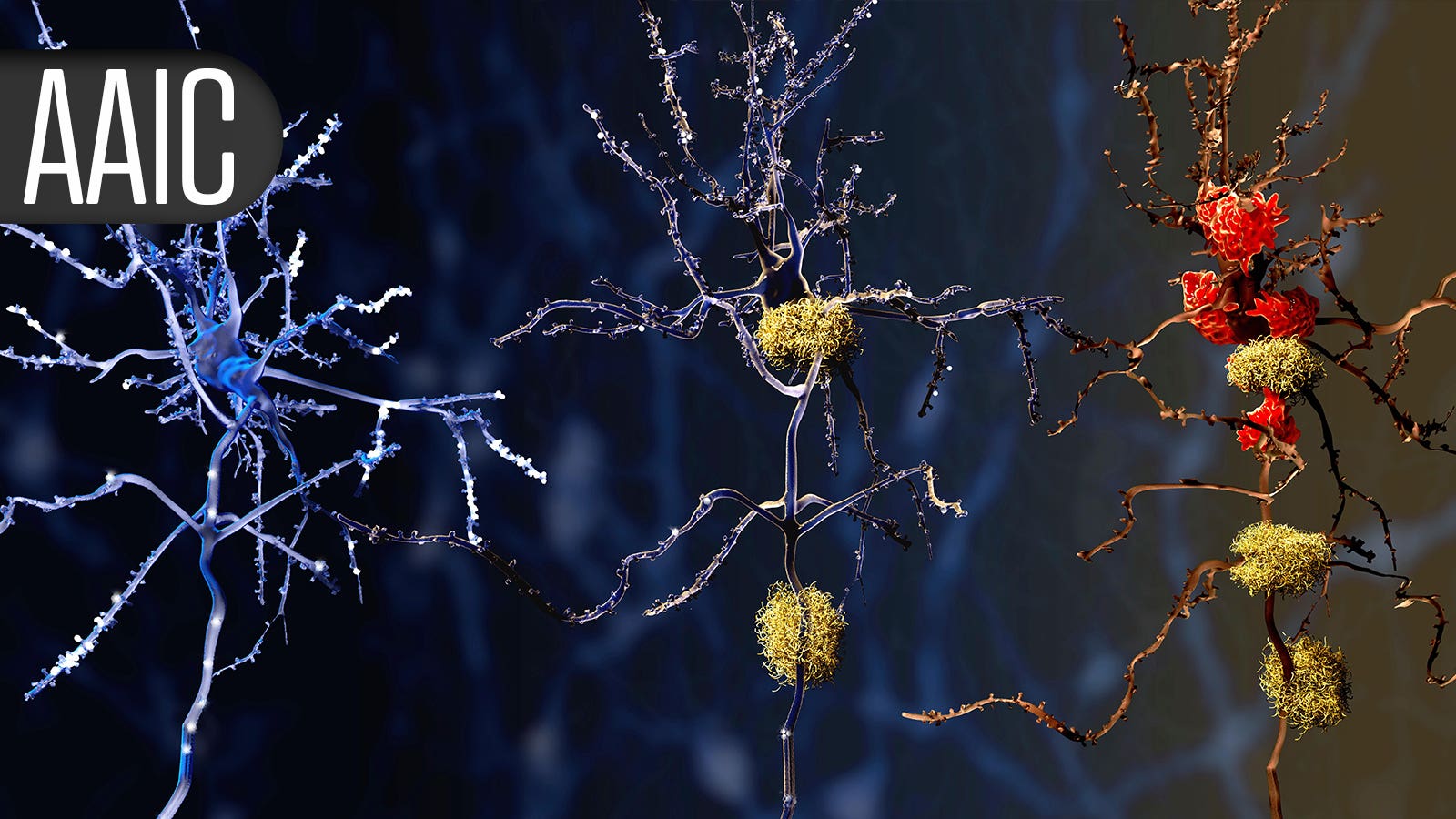 Dementia prevention is not one-size-fits-all, study shows