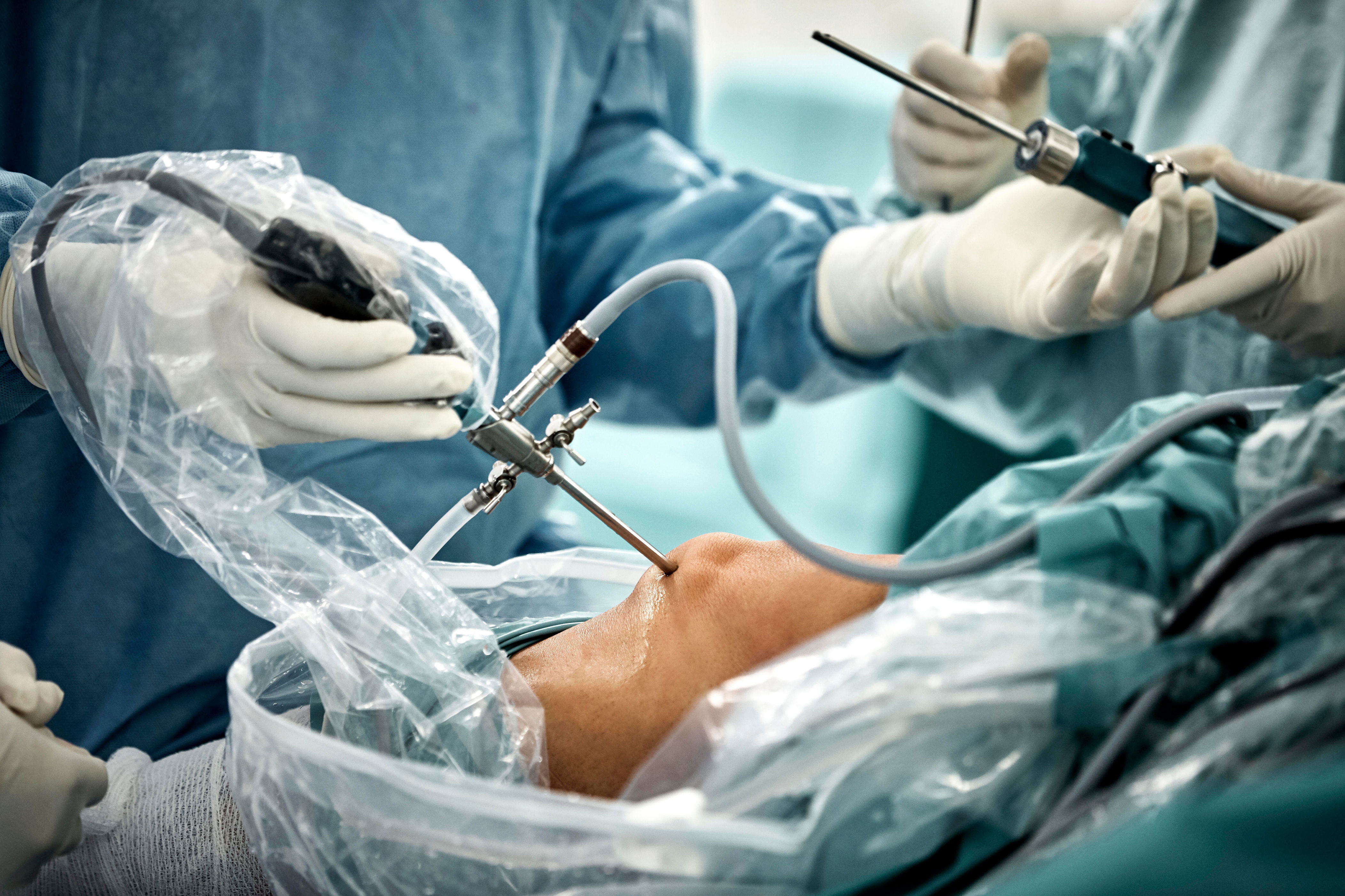 An arthroscopic knee surgery. / Credit: Morsa Images / Getty Images