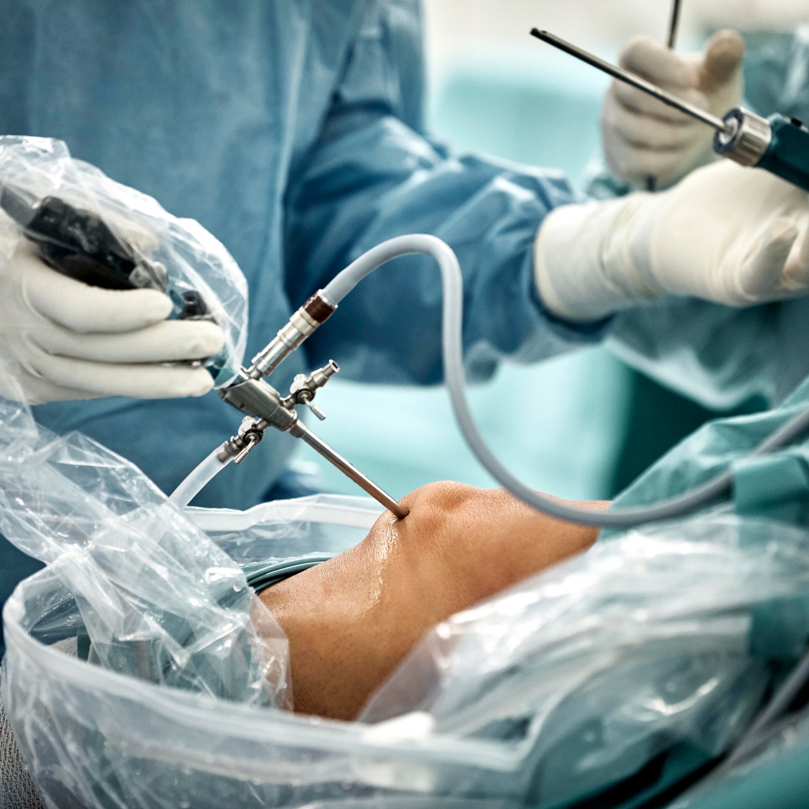 Close up of hands performing arthroscopic surgery on knee