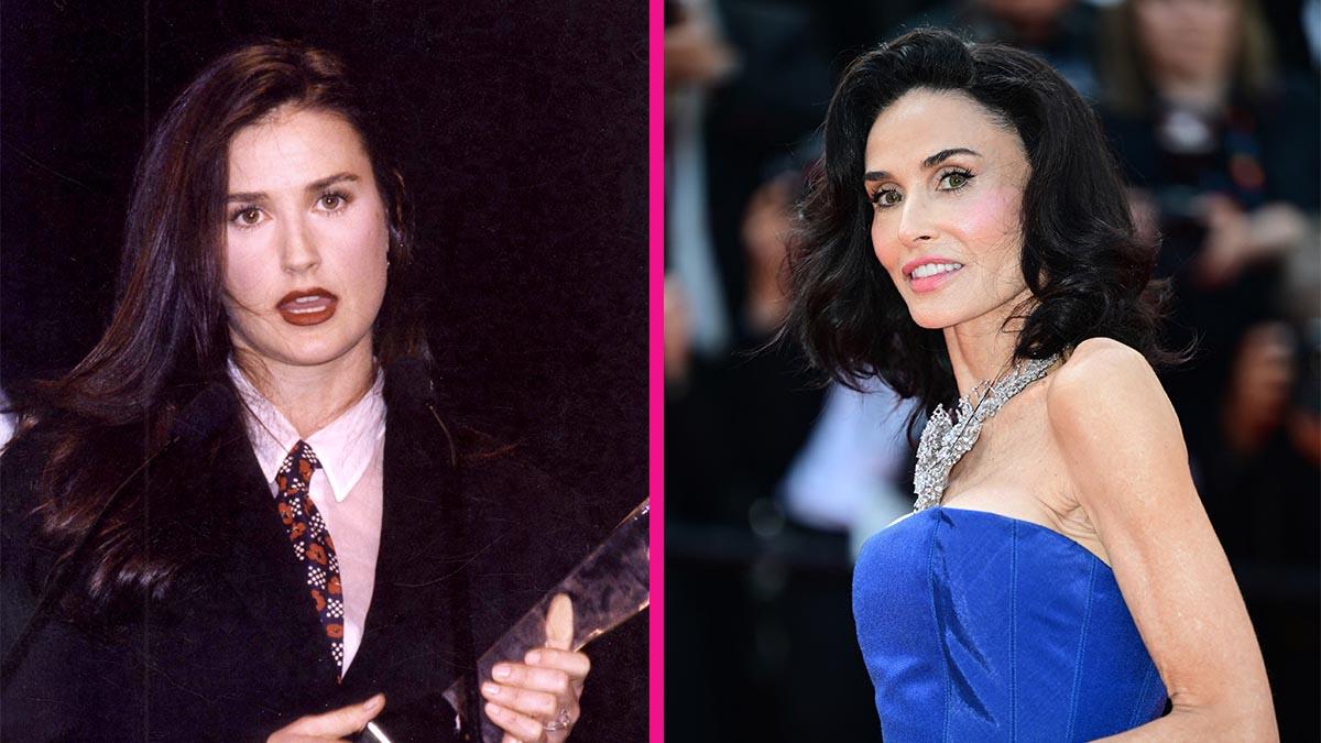 Demi Moore, 63, Is Aging in Reverse as Surgeon Weighs in on 'Natural' Procedure That Could Be Behind Her Timeless Look: See Before-and-After Photos
