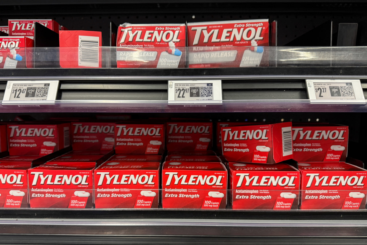 Appeals court revives lawsuits alleging Tylenol causes autism and ADHD